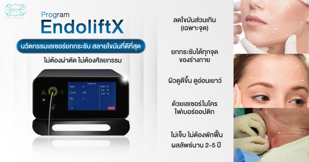 หลักการทำงานของ Endolift X
